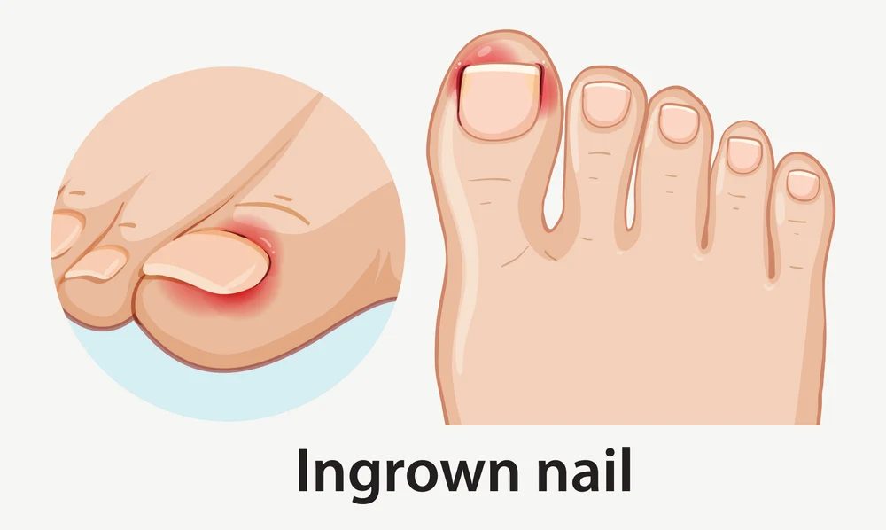 Toenail health and nail-care concerns